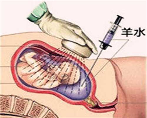 香港怀孕验血要多少钱,多年难孕难育夫妻进行辅助生殖助孕